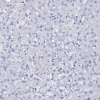 Anti-FBXL16 Antibody