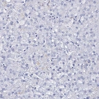 Immunohistochemical staining of human liver shows no positivity in hepatocytes as expected.