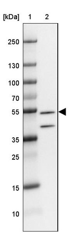 Lane 1: Marker [kDa] 250, 130, 100, 70, 55, 35, 25, 15, 10_br/_Lane 2: Human Cerebral Cortex tissue