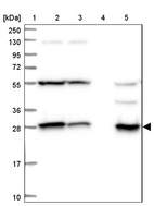 Lane 1: Marker [kDa] 250, 130, 95, 72, 55, 36, 28, 17, 10_br/_Lane 2: Human cell line RT-4_br/_Lane 3: Human cell line U-251MG sp_br/_Lane 4: Human plasma (IgG/HSA depleted)_br/_Lane 5: Human liver tissue