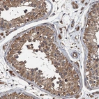 Anti-BORCS5 Antibody