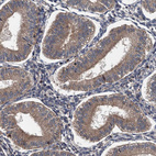 Immunohistochemical staining of human endometrium shows moderate cytoplasmic positivity in glandular cells.