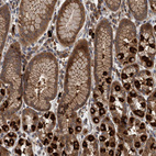 Immunohistochemical staining of human stomach shows moderate to strong cytoplasmic positivity in glandular cells.
