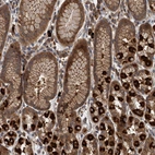 Immunohistochemical staining of human stomach shows moderate to strong cytoplasmic positivity in glandular cells.