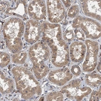 Immunohistochemical staining of human kidney shows weak cytoplasmic positivity in cells in tubules.