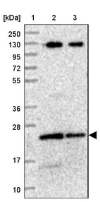 Lane 1: Marker [kDa] 250, 130, 95, 72, 55, 36, 28, 17, 10_br/_Lane 2: Human cell line RT-4_br/_Lane 3: Human cell line U-251MG sp
