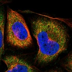 Immunofluorescent staining of human cell line U-2 OS shows localization to cytosol.