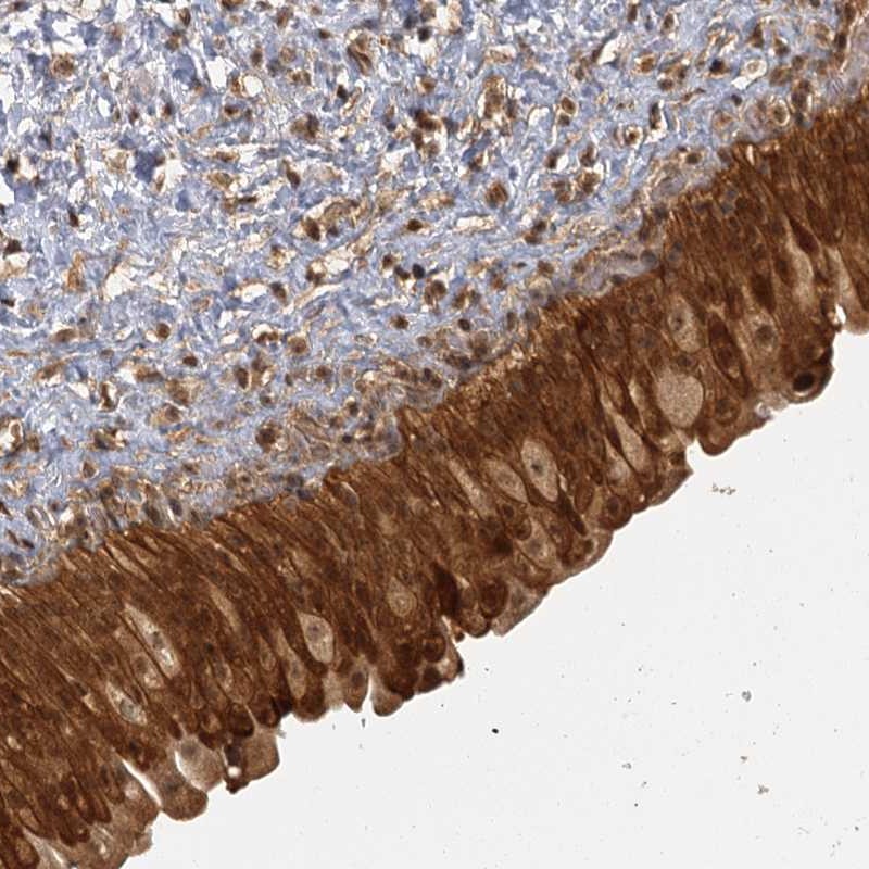 Anti-ZNF549 Antibody
