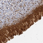 Anti-ZNF549 Antibody