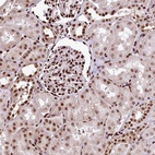 Anti-PDS5B Antibody