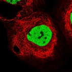 Immunofluorescent staining of human cell line A-431 shows localization to nucleoplasm.