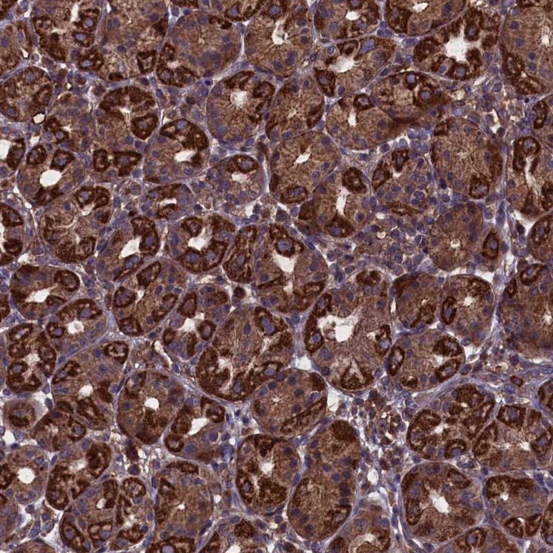 Anti-MYO1H Antibody