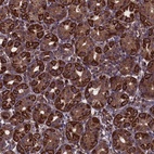Anti-MYO1H Antibody