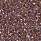 Anti-MYO1H Antibody