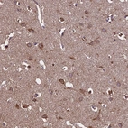 Anti-KCNG1 Antibody