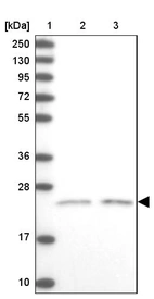 Lane 1: Marker [kDa] 250, 130, 95, 72, 55, 36, 28, 17, 10_br/_Lane 2: Human cell line RT-4_br/_Lane 3: Human cell line U-251MG sp