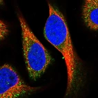 Immunofluorescent staining of human cell line U-2 OS shows localization to vesicles.