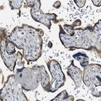 Anti-STARD13 Antibody