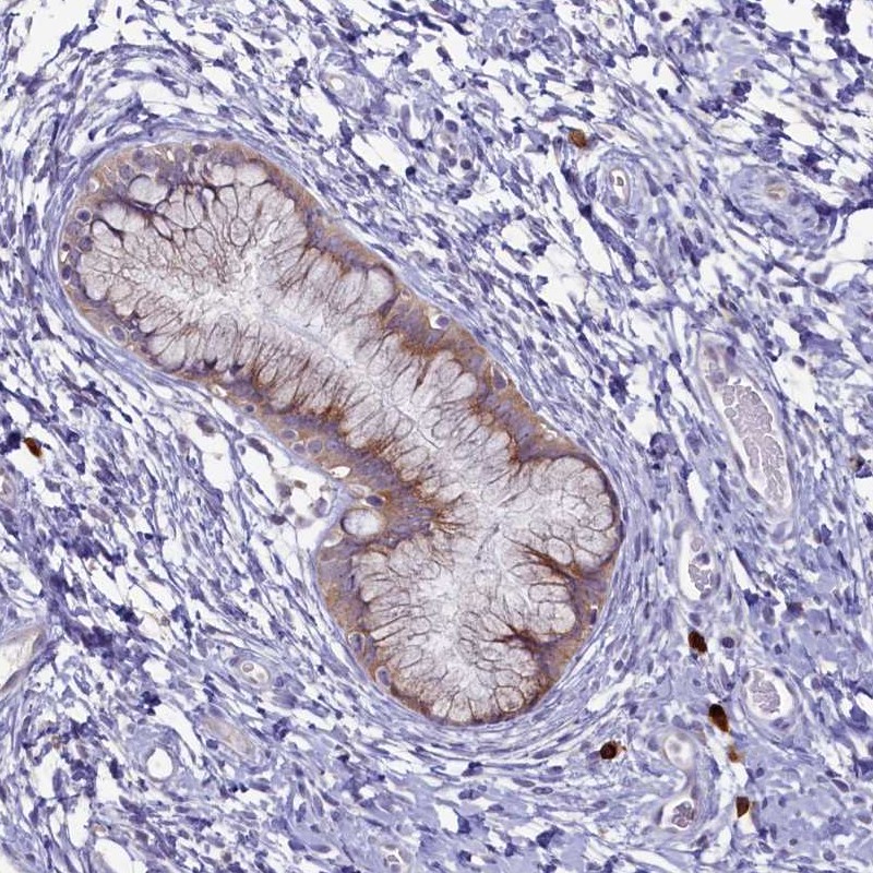 Anti-METTL25 Antibody