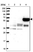 Lane 1: Marker [kDa] 250, 130, 95, 72, 55, 36, 28, 17, 10_br/_Lane 2: Human cell line RT-4_br/_Lane 3: Human cell line U-251MG sp_br/_Lane 4: Human plasma (IgG/HSA depleted)