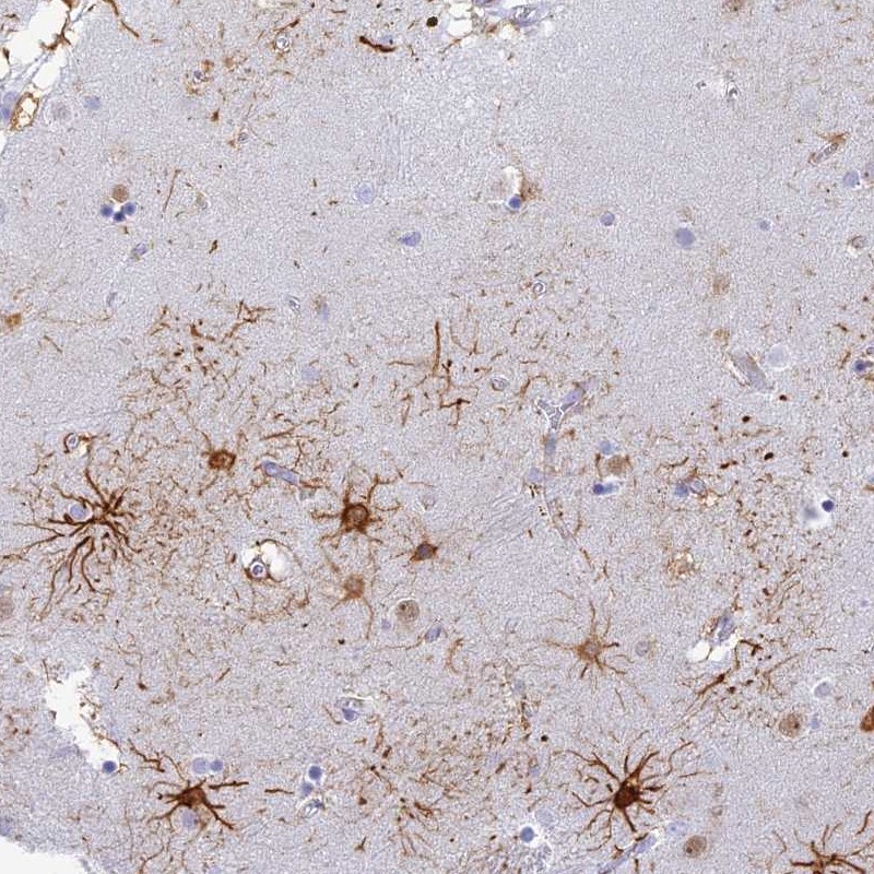 Anti-INTS13 Antibody