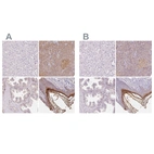 Immunohistochemical staining of human liver, pancreas, prostate and skin using Anti-BLMH antibody HPA039548 (A) shows similar protein distribution across tissues to independent antibody HPA064307 (B).