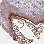 Immunohistochemical staining of human skin shows strong cytoplasmic positivity in epidermal cells in corneal layer.