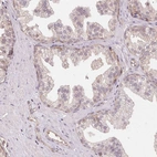 Immunohistochemical staining of human prostate shows no cytoplasmic positivity in glandular cells as expected.