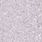 Immunohistochemical staining of human liver shows no cytoplasmic positivity in hepatocytes.