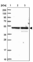 Lane 1: Marker [kDa] 250, 130, 95, 72, 55, 36, 28, 17, 10_br/_Lane 2: Human cell line RT-4_br/_Lane 3: Human cell line U-251MG sp
