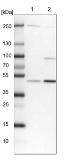 Lane 1: NIH-3T3 cell lysate (Mouse embryonic fibroblast cells)_br/_Lane 2: NBT-II cell lysate (Rat Wistar bladder tumour cells)