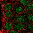 Anti-MAB21L3 Antibody