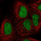 Immunofluorescent staining of human cell line HEK 293 shows localization to nucleoplasm.