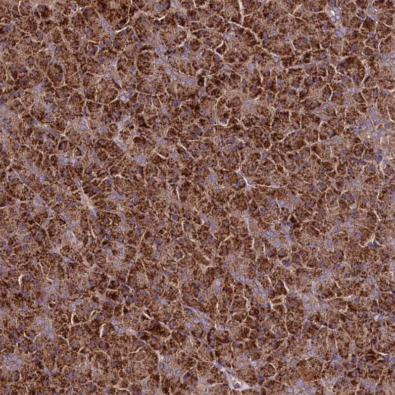 Anti-TNPO3 Antibody