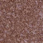 Anti-TNPO3 Antibody