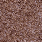 Anti-TNPO3 Antibody