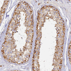 Anti-DONSON Antibody