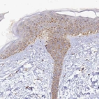 Immunohistochemical staining of human skin shows moderate granular cytoplasmic positivity in squamous epithelial cells.
