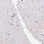 Immunohistochemical staining of human skeletal muscle shows no positivity in myocytes as expected.