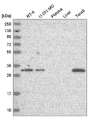 Western blot analysis in human cell line RT-4, human cell line U-251 MG, human plasma, human liver tissue and human tonsil tissue.