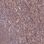Immunohistochemical staining of human spleen shows moderate membranous positivity in cells in red pulp.