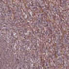 Immunohistochemical staining of human spleen shows moderate membranous positivity in cells in red pulp.