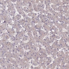 Immunohistochemical staining of human liver shows very weak membranous positivity in hepatocytes.