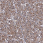 Anti-HTR3B Antibody