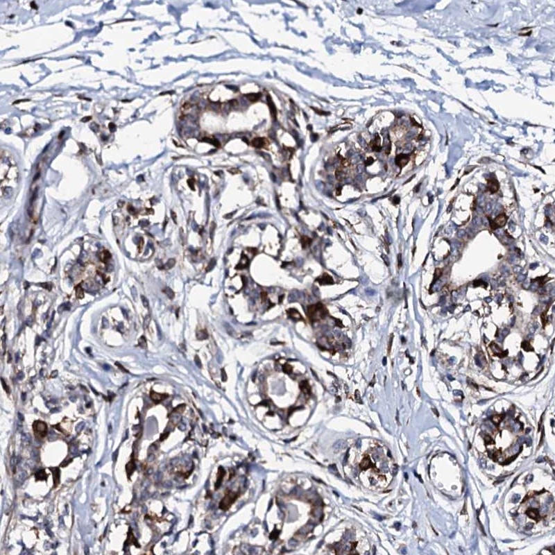 Anti-TMCO3 Antibody