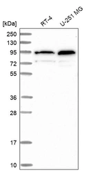 Western blot analysis in human cell line RT-4 and human cell line U-251 MG.