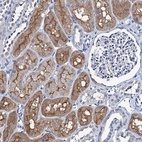 Immunohistochemical staining of human kidney shows high expression.