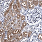 Immunohistochemical staining of human kidney shows high expression.