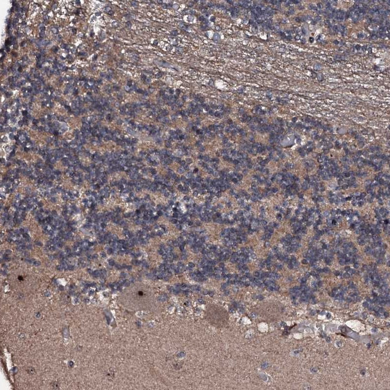 Anti-SUPT7L Antibody