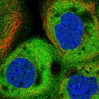 Immunofluorescent staining of human cell line A-431 shows positivity in plasma membrane & cytoplasm.